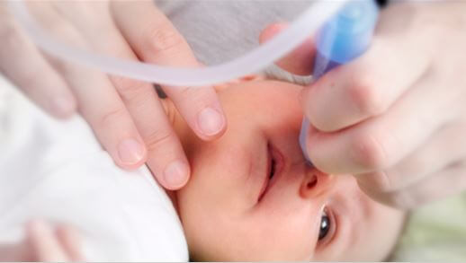 aspirador nasal de cánula para bebé